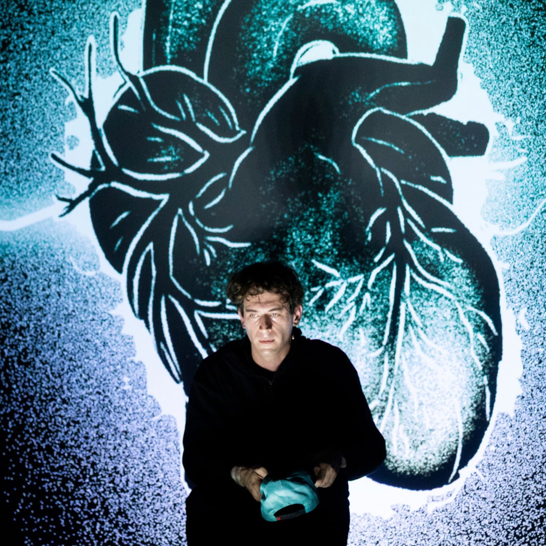 ImmSitoAnteprima_Cuore di porco_D